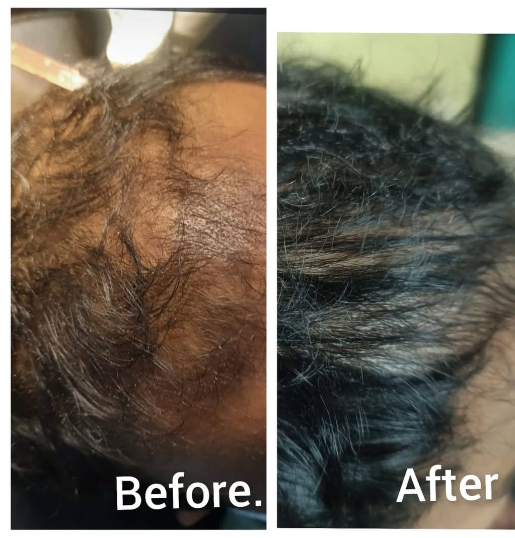 Before and After 1