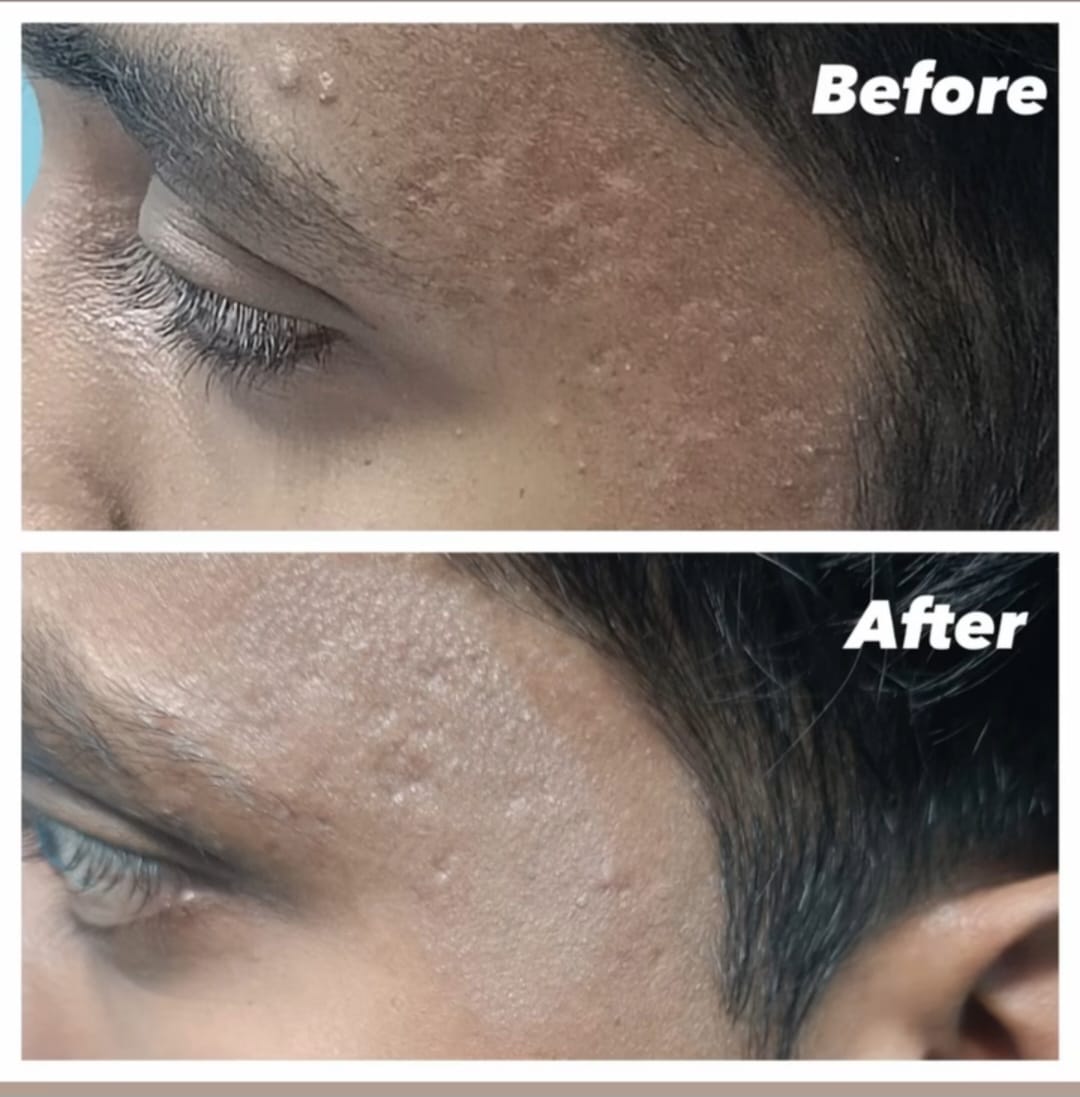 Before and After 2