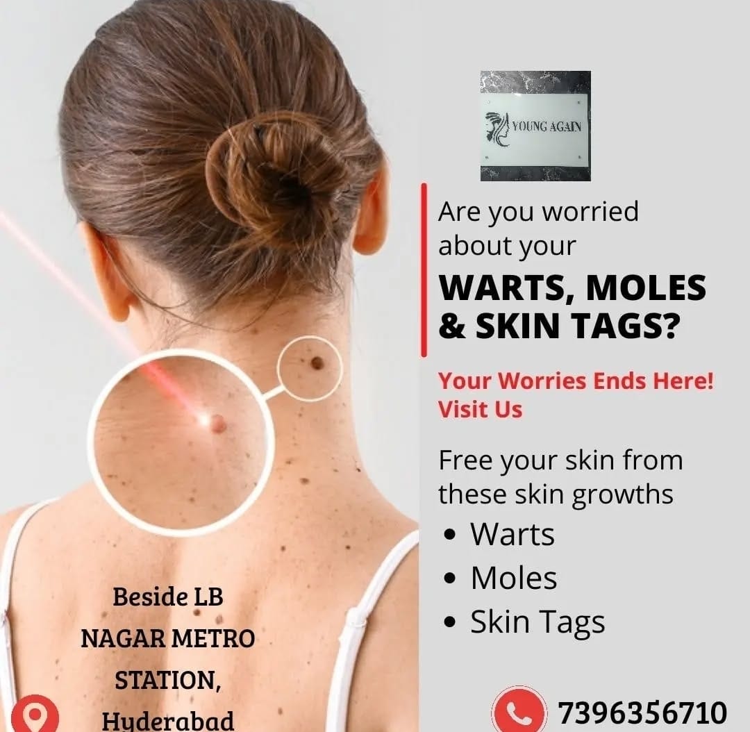 Skin Treatments